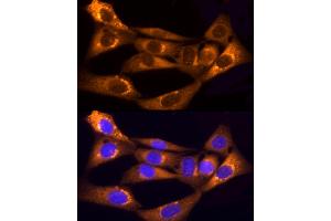 Immunofluorescence analysis of NIH/3T3 cells using Collagen I/COL1 Rabbit pAb (352) at dilution of 1:150 (40x lens).