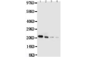 Anti-mouse IL18 antibody, Western blotting Lane 1: Recombinant Mouse IL18 Protein 10ng Lane 2: Recombinant Mouse IL18 Protein 5ng Lane 3: Recombinant Mouse IL18 Protein 2 (IL-18 anticorps  (AA 36-192))