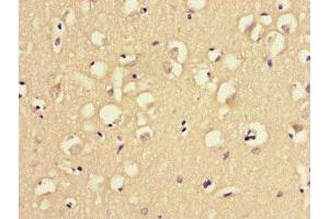 Immunohistochemistry of paraffin-embedded human brain tissue using ABIN7159790 at dilution of 1:100 (MAST1 anticorps  (AA 687-879))