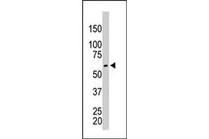 The PKM2 polyclonal antibody  is used in Western blot to detect PKM2 in HeLa cell lysate . (PKM2 anticorps  (AA 483-513))