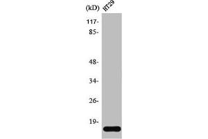 Western Blot analysis of HT29 cells using Synuclein-γ Polyclonal Antibody (SNCG anticorps  (C-Term))