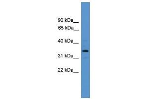Western Blot showing ARG2 antibody used at a concentration of 1-2 ug/ml to detect its target protein.