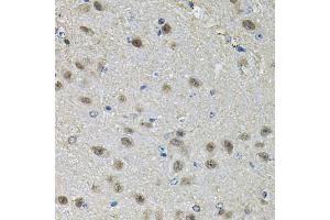Immunohistochemistry of paraffin-embedded mouse brain using PPID Antibody (ABIN5974177) at dilution of 1/100 (40x lens). (PPID anticorps)