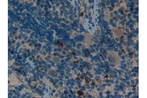 Detection of LIFR in Rat Spleen Tissue using Polyclonal Antibody to Leukemia Inhibitory Factor Receptor (LIFR)