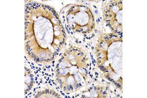 Immunohistochemistry of paraffin-embedded human colon using CDK7 antibody (ABIN5970847) at dilution of 1/200 (40x lens).