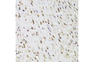 Immunohistochemistry of paraffin-embedded human leiomyoma of uterus using SEPHS1 Antibody.