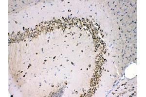 IHC testing of FFPE mouse brain with MPS1 antibody at 1ug/ml. (RPS27 anticorps)