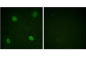 Immunofluorescence staining of methanol-fixed HeLa cells using hnRPD (Phospho-Ser83) Antibody.