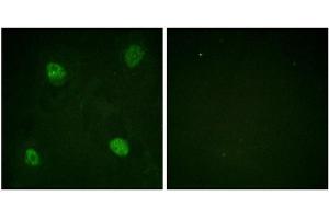 Immunofluorescence staining of methanol-fixed HeLa cells using hnRPD (Phospho-Ser83) Antibody. (HNRNPD/AUF1 anticorps  (pSer83))