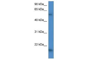 GPT2 antibody used at 1 ug/ml to detect target protein. (GPT2 anticorps)