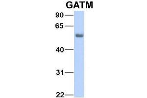 Host:  Rabbit  Target Name:  NSUN6  Sample Type:  Human Fetal Lung  Antibody Dilution:  1.