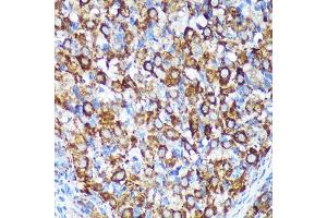 Immunohistochemistry of paraffin-embedded Rat ovary using [KO Validated] CHCHD2 Rabbit pAb (ABIN7266448) at dilution of 1:100 (40x lens). (CHCHD2 anticorps  (AA 75-145))