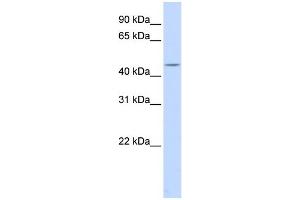 WB Suggested Anti-HSFY1 Antibody Titration:  0. (HSFY1 anticorps  (Middle Region))