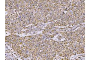 IHC analysis of CLASP1 using anti-CLASP1 antibody (ABIN7599144). (CLASP1 anticorps  (AA 1-243))