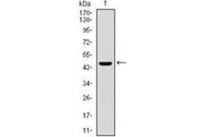 Western Blotting (WB) image for anti-Argininosuccinate Synthase 1 (ASS1) antibody (ABIN1105455) (ASS1 anticorps)