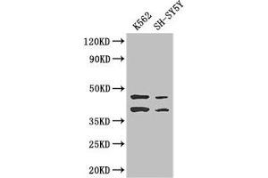 Western Blot Positive WB detected in: K562 whole cell lysate, SH-SY5Y whole cell lysate All lanes: AIM2 antibody at 2. (AIM2 anticorps  (AA 81-326))