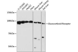 Western blot analysis of extracts of various cell lines, using Glucocorticoid Receptor antibody (ABIN7269016) at 1:1000 dilution.