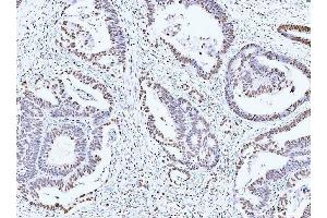 IHC analysis of MCM6 using anti-MCM6 antibody (ABIN7600037). (MCM6 anticorps  (AA 14-821))