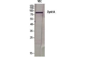 Western Blot (WB) analysis of specific cells using Dyrk1A Polyclonal Antibody. (DYRK1A anticorps  (N-Term))