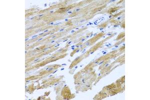 Immunohistochemistry of paraffin-embedded rat heart using MOK antibody. (MOK anticorps)