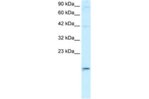 Western Blotting (WB) image for anti-Apolipoprotein B mRNA Editing Enzyme, Catalytic Polypeptide-Like 3G (APOBEC3G) antibody (ABIN2460746) (APOBEC3G anticorps)