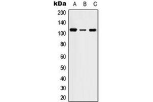 Western blot analysis of STK31 expression in HEK293T (A), SP2/0 (B), PC12 (C) whole cell lysates. (STK31 anticorps  (Center))