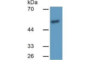 Mouse Capture antibody from the kit in WB with Positive Control: Sample Human Placenta Tissue. (MMP11 Kit ELISA)