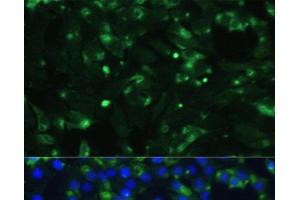 Immunofluorescence analysis of C6 cells using ENO1 Polyclonal Antibody at dilution of 1:100.