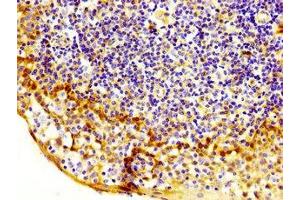 IHC image of ABIN7169043 diluted at 1:200 and staining in paraffin-embedded human tonsil tissue performed on a Leica BondTM system.