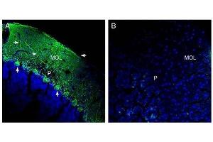 Expression of SLC38A1 in rat cerebellum.