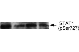 Western blot analysis of extract from thyroid cancer cell line Bph cells, using STAT1 (phospho-Ser727) antibody (E011163). (STAT1 anticorps  (pSer727))