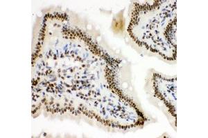 IHC-P: HIF-1-alpha antibody testing of mouse intestine tissue