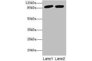 Western blot All lanes: POSTN antibody at 2 μg/mL Lane 1: Mouse liver tissue Lane 2: Hela whole cell lysate Secondary Goat polyclonal to rabbit IgG at 1/10000 dilution Predicted band size: 94, 88, 84, 91, 81 kDa Observed band size: 94 kDa (Periostin anticorps  (AA 24-836))