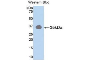 Western blot analysis of the recombinant protein. (Pkc beta 1 anticorps  (AA 342-600))