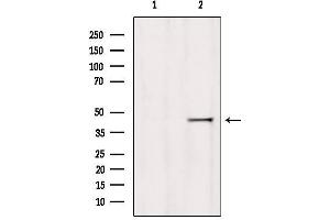 Western blot analysis of extracts from 293, using HOMER1 Antibody. (HOMER1 anticorps  (Internal Region))