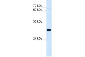 WB Suggested Anti-Antp Antibody Titration:  0. (HOXA7 anticorps  (C-Term))