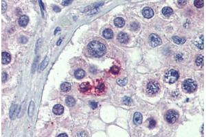 Testis, Human: Formalin-Fixed, Paraffin-Embedded (FFPE)