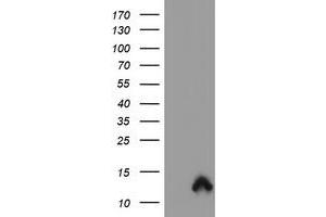 Image no. 1 for anti-S100 Calcium Binding Protein P (S100P) antibody (ABIN1500789) (S100P anticorps)