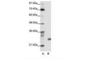 Image no. 1 for anti-Sin3A-Associated Protein, 30kDa (SAP30) (N-Term) antibody (ABIN202078) (SAP30 anticorps  (N-Term))