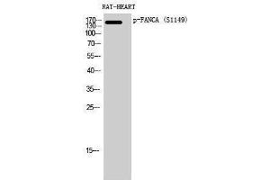 Western Blotting (WB) image for anti-Fanconi Anemia Group A Protein (FANCA) (pSer1149) antibody (ABIN3182820) (FANCA anticorps  (pSer1149))