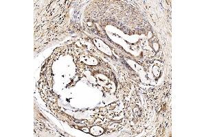 IHC analysis of HMGCS2 using anti-HMGCS2 antibody (ABIN7599435). (HMGCS2 anticorps  (AA 1-487))