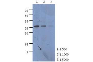 The extracts of HeLa (40ug) were resolved by SDS-PAGE, transferred to PVDF membrane and probed with anti-human CMBL antibody (1:500 ~ 1:5000). (CMBL anticorps)