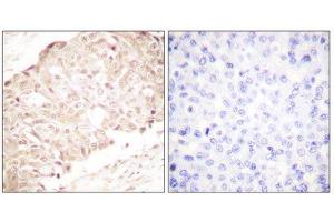 Immunohistochemistry (IHC) image for anti-SUMO1/sentrin Specific Peptidase 1 (SENP1) (N-Term) antibody (ABIN1848840) (SENP1 anticorps  (N-Term))