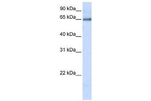 Western Blotting (WB) image for anti-DNA Cross-Link Repair 1C (DCLRE1C) antibody (ABIN2459466) (DCLRE1C anticorps)