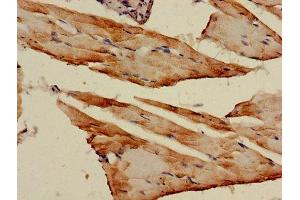 Immunohistochemistry of paraffin-embedded human skeletal muscle tissue using ABIN7143343 at dilution of 1:100 (Adenylate Kinase 1 anticorps  (AA 1-194))