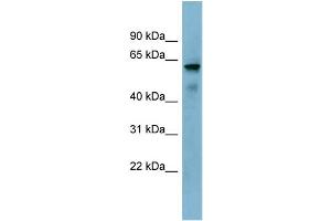 WB Suggested Anti-KIAA1627 Antibody Titration:  0. (KIAA1627 anticorps  (N-Term))
