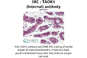 Image no. 1 for anti-TAO Kinase 1 (TAOK1) (Internal Region) antibody (ABIN1739900) (TAO Kinase 1 (TAOK1) (Internal Region) anticorps)