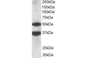 Western Blotting (WB) image for anti-Protein Kinase C and Casein Kinase Substrate in Neurons 1 (PACSIN1) (N-Term) antibody (ABIN2465262) (PACSIN1 anticorps  (N-Term))