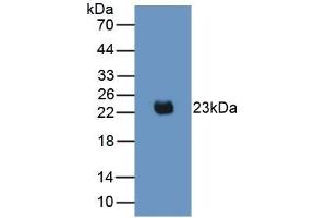 Detection of Recombinant IL2, Mouse using Monoclonal Antibody to Interleukin 2 (IL2) (IL-2 anticorps  (AA 10-169))