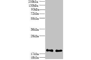 Western blot All lanes: PPP3R1 antibody at 1 μg/mL Lane 1: K562 whole cell lysate Lane 2: Hela whole cell lysate Secondary Goat polyclonal to rabbit IgG at 1/10000 dilution Predicted band size: 20 kDa Observed band size: 20 kDa